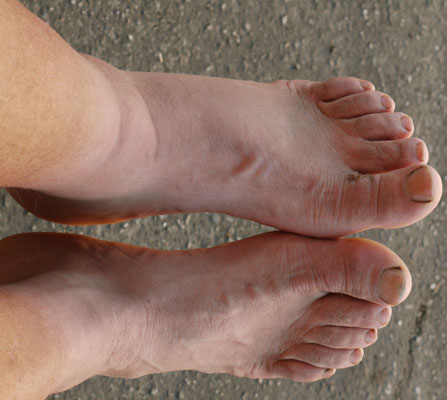My Feet, June 3